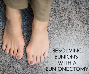 Resolving Bunions With A Bunionectomy