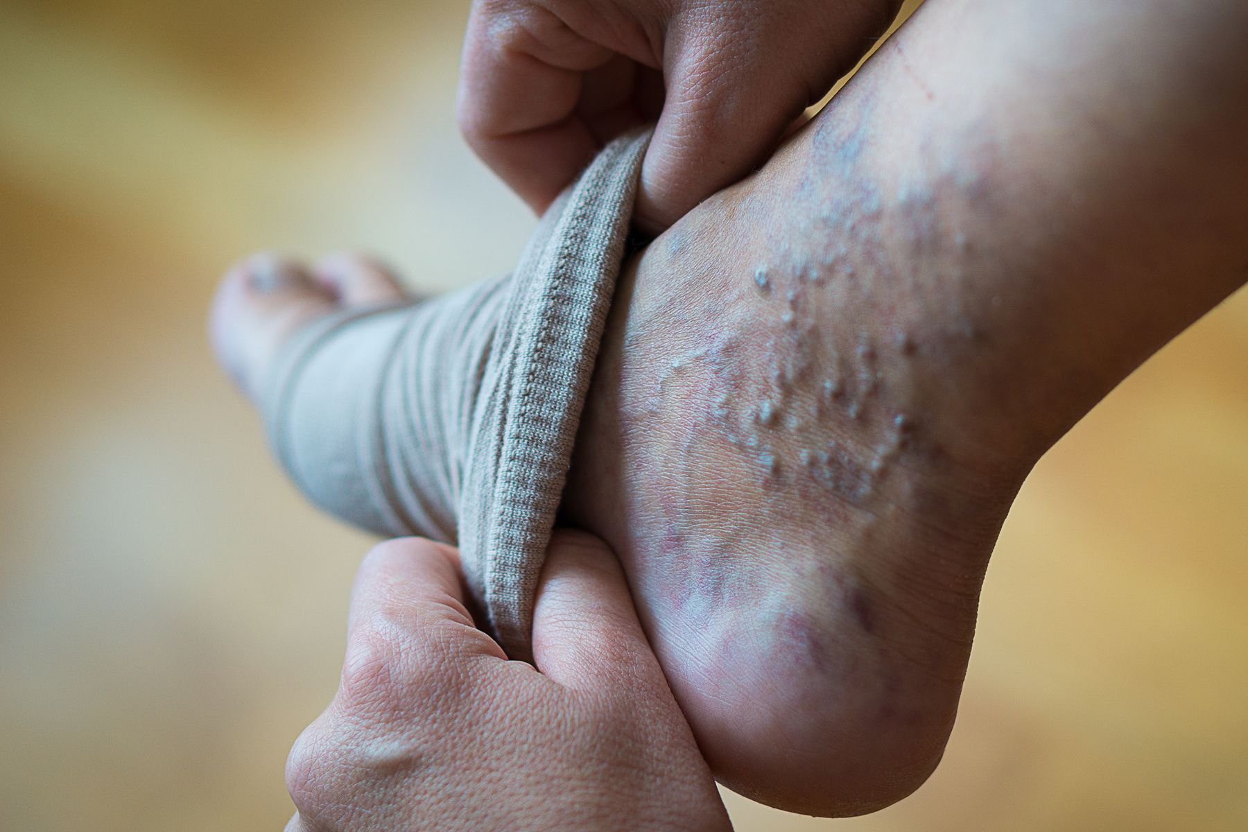Dynamic Medical Center Interventional Vein Ablation
