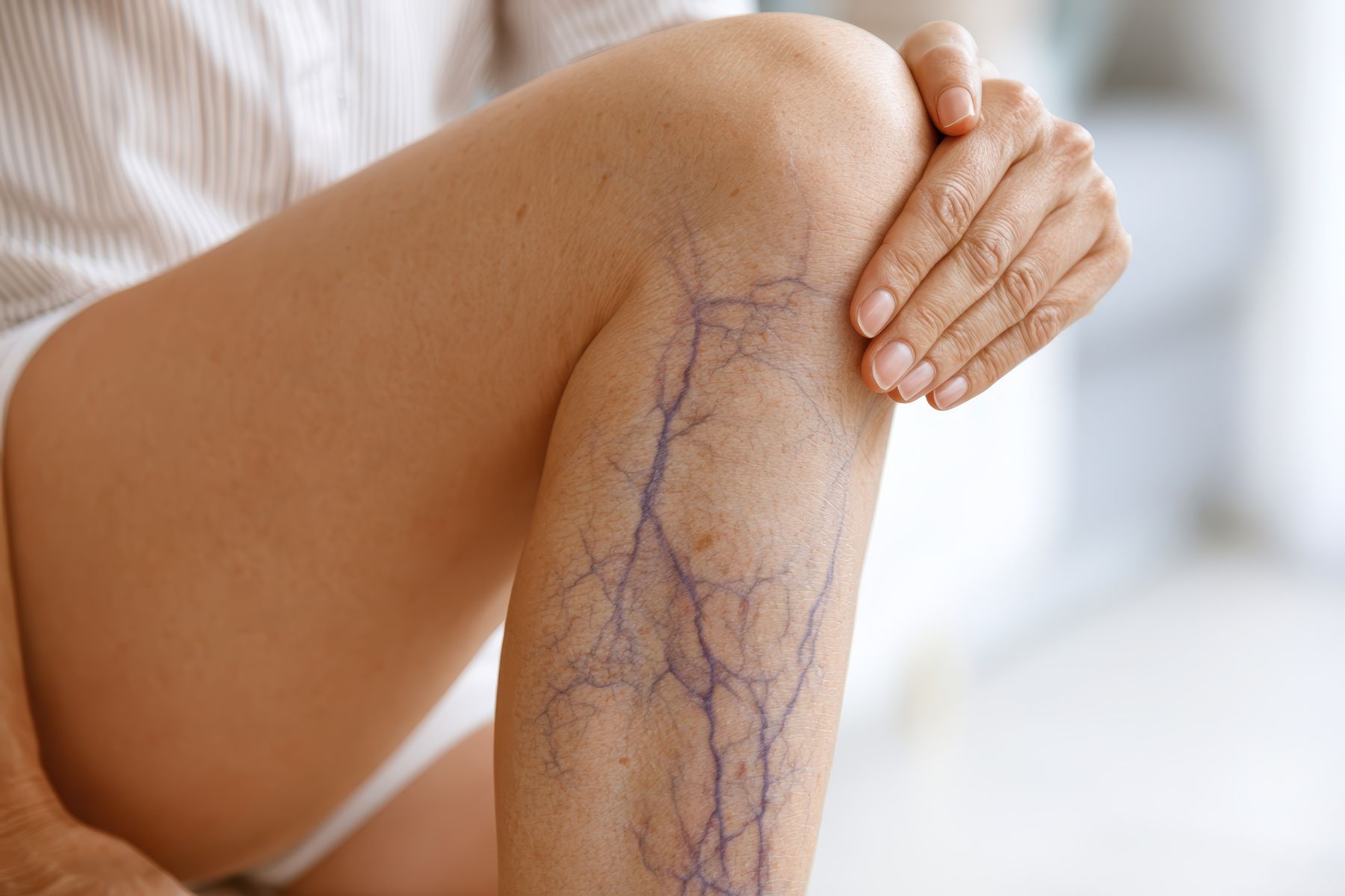 Dynamic Medical Center Interventional Vein Ablation