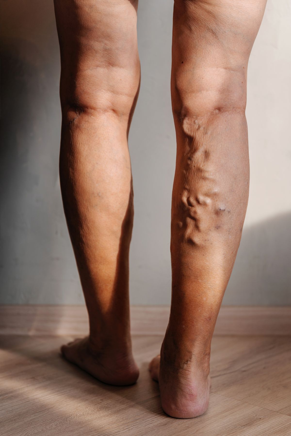 Dynamic Medical Center Interventional Vein Ablation