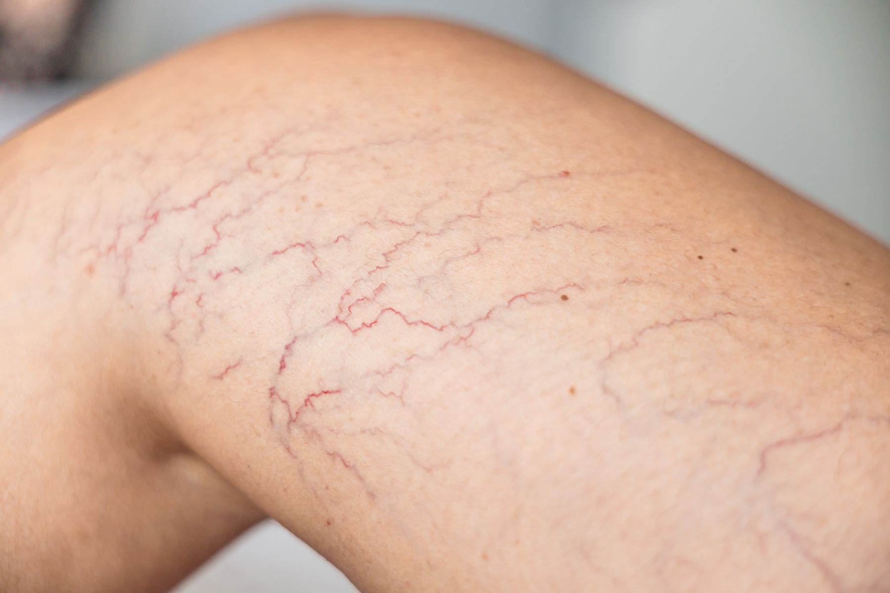 Dynamic Medical Centers Venous Insufficiency